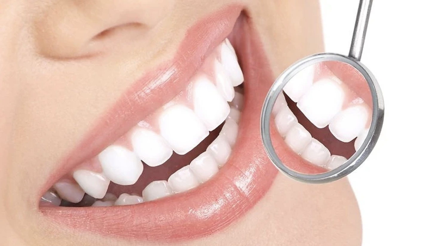 All-on-4 Sorriso