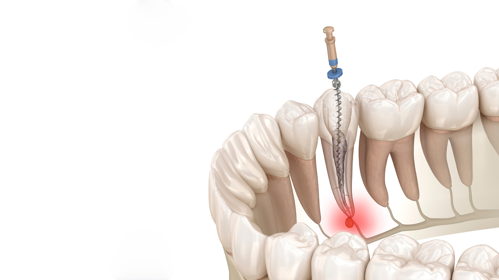 Endodontia