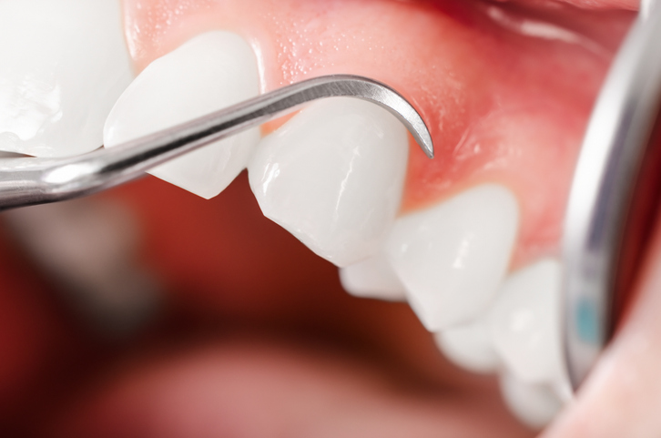 Periodontologia